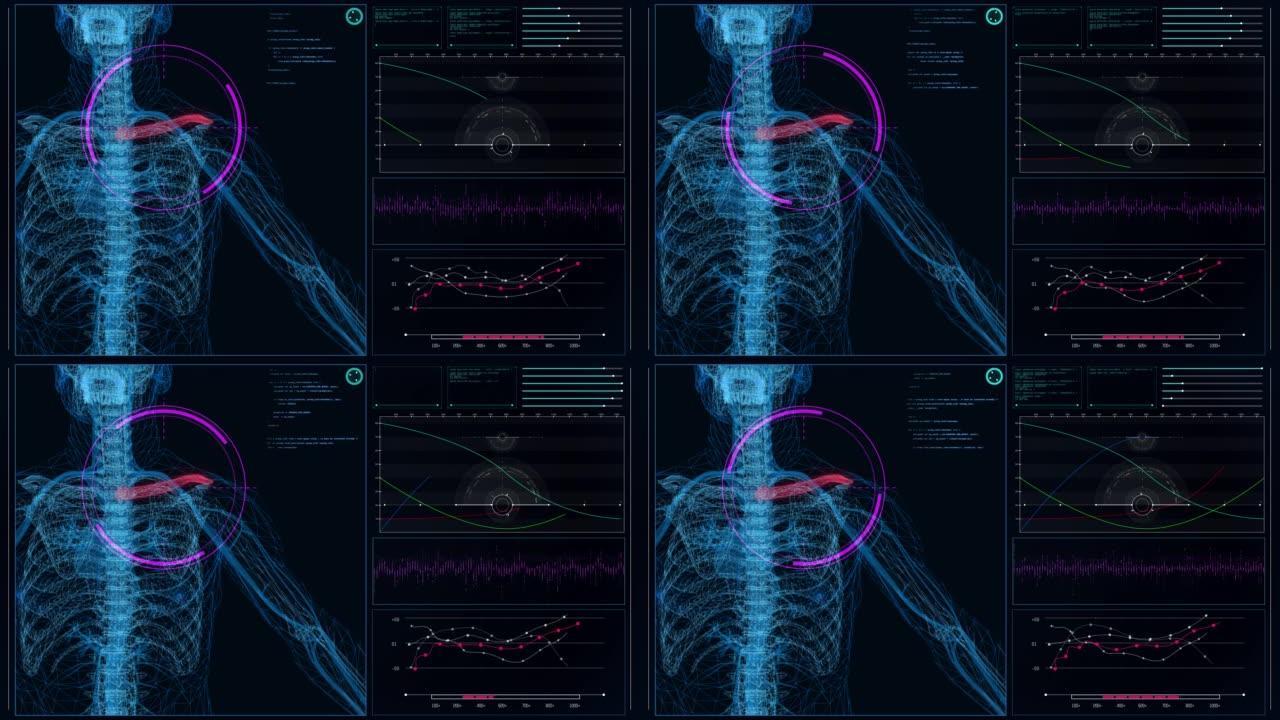 HUD与人体模型的接口。扫描虚拟患者肩伤。