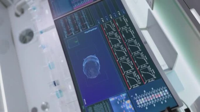 实验室设备、脑电波扫描耳机和计算机。屏幕上的脑电波研究。垂直视频