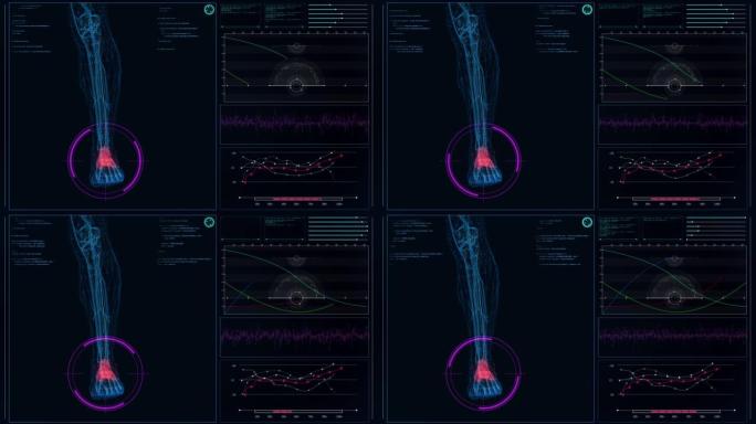 HUD与人体模型的接口。扫描虚拟患者的脚骨损伤。