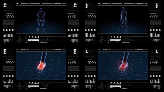 有病理学的人。男孩的3d身体。男性人形。