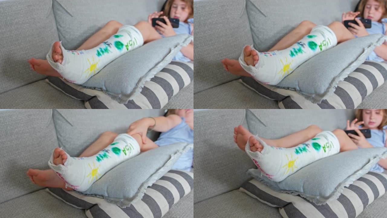 年轻的高加索女孩躺在沙发上抓挠受伤的断骨腿上的瘙痒皮肤，用整形石膏石膏壳稳定下来