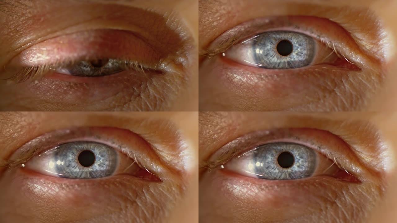 SLO MO LD灰色眼睛张开和瞳孔适应光线