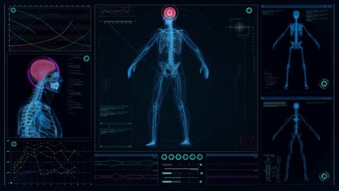 未来实验室。带有动画人体模型的屏幕。扫描虚拟病人是否受伤。红点脑损伤
