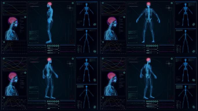 未来实验室。带有动画人体模型的屏幕。扫描虚拟病人是否受伤。红点脑损伤