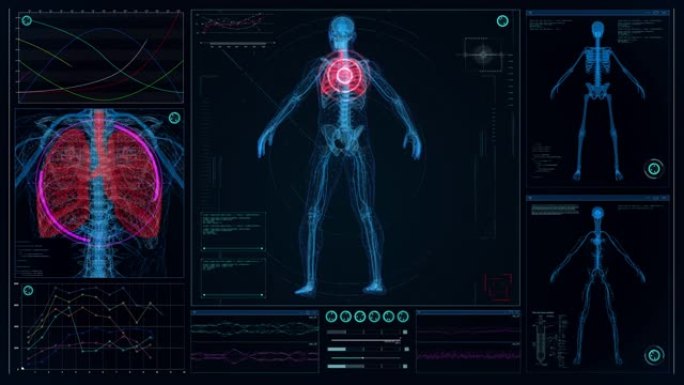 未来实验室。带有动画人体模型的屏幕。扫描虚拟病人是否受伤。胸部有红色标记
