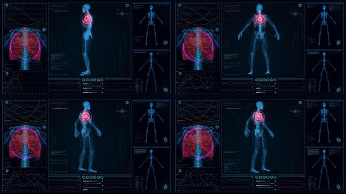 未来实验室。带有动画人体模型的屏幕。扫描虚拟病人是否受伤。胸部有红色标记