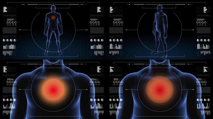 有病理学的人。男孩的3d身体。男性人形。