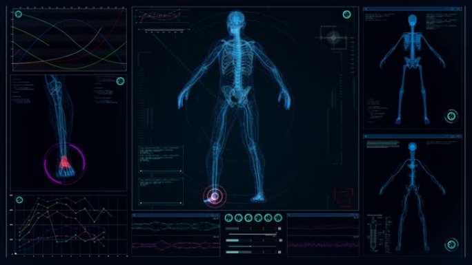 未来实验室。带有动画人体模型的屏幕。扫描虚拟病人是否受伤。踝关节疼痛隐喻