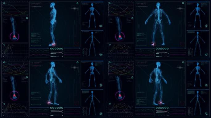 未来实验室。带有动画人体模型的屏幕。扫描虚拟病人是否受伤。踝关节疼痛隐喻