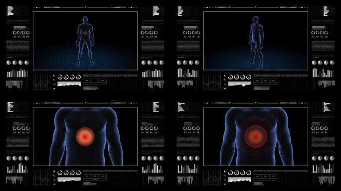 胃部病变的人。男孩的3d身体。男性人体结构的旋转动画和特写。