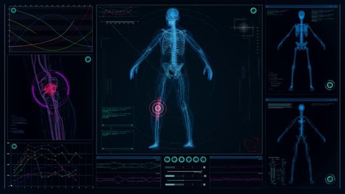 未来实验室。带有动画人体模型的屏幕。扫描虚拟病人是否受伤。带红点的膝盖损伤