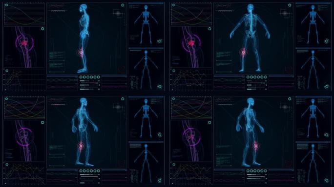 未来实验室。带有动画人体模型的屏幕。扫描虚拟病人是否受伤。带红点的膝盖损伤