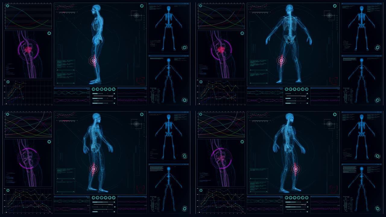 未来实验室。带有动画人体模型的屏幕。扫描虚拟病人是否受伤。带红点的膝盖损伤