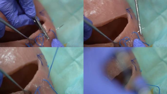 妇科外科医生学生的实践