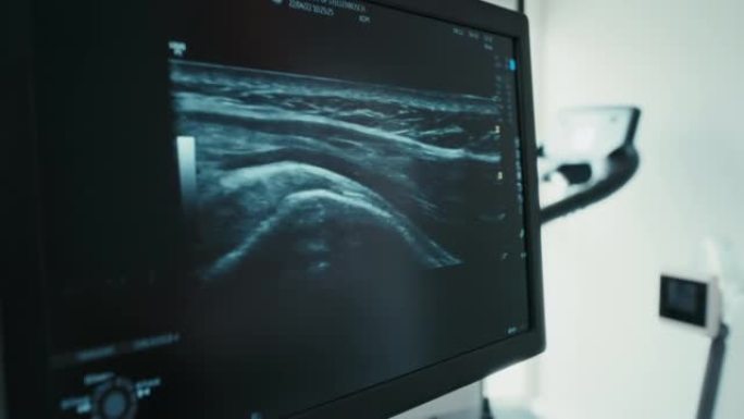 使用超声波扫描检查患者肩部受伤的物理治疗师的特写镜头。医学运动科学家双手指向并显示，以解释过度训练造