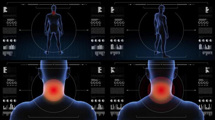 有病理学的人。男孩的3d身体。男性人形。