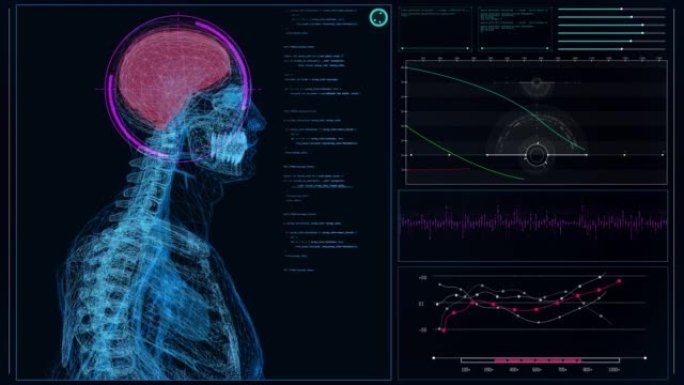 HUD接口与大脑分析。扫描虚拟患者的脑部损伤
