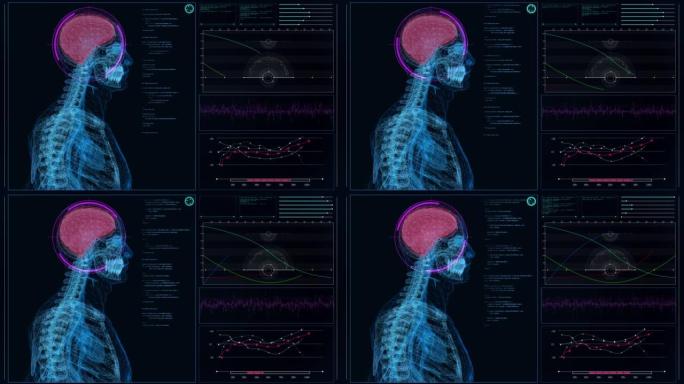 HUD接口与大脑分析。扫描虚拟患者的脑部损伤