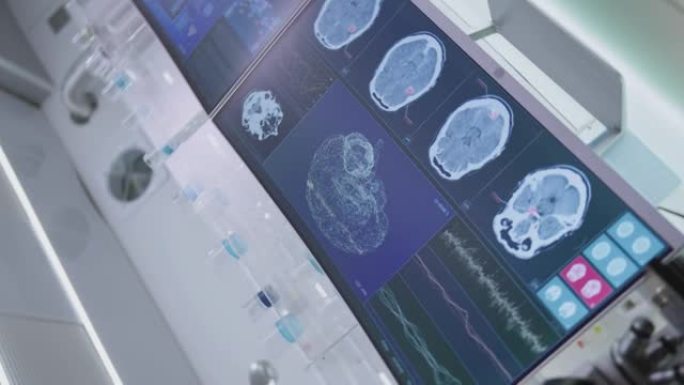 实验室设备、脑电波扫描耳机和计算机。屏幕上的脑电波研究。垂直视频