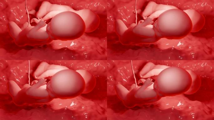 3d在子宫内呈现医学上准确的双胞胎，具有单个胎盘的子宫中的单卵双胞胎，人类双胞胎胎儿，产前生长的婴儿