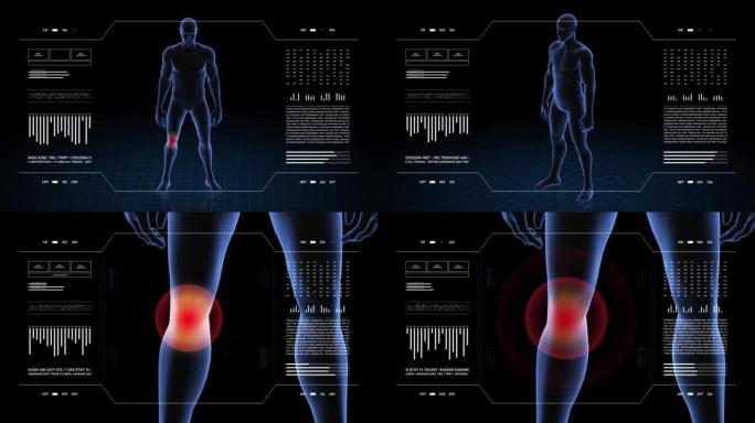 有病理学的人。男孩的3d身体。男性人形。