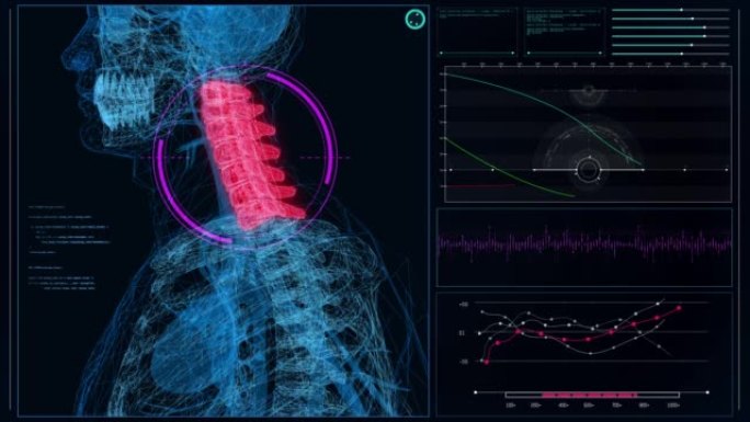 HUD与人体模型的接口。扫描虚拟病人。颈部损伤