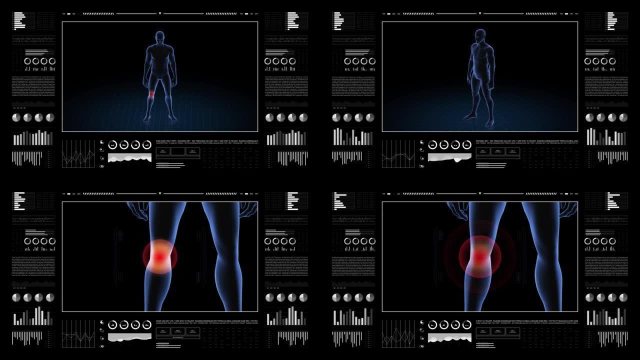 有病理学的人。男孩的3d身体。男性人形。