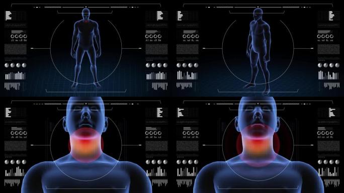 有病理学的人。男孩的3d身体。男性人形。