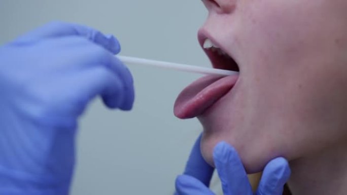 侧视特写女性嘴巴，舌头伸出，医生手插入一次性抹刀。无法辨认的白人少女在诊所接受医学检查。耳鼻喉科概念