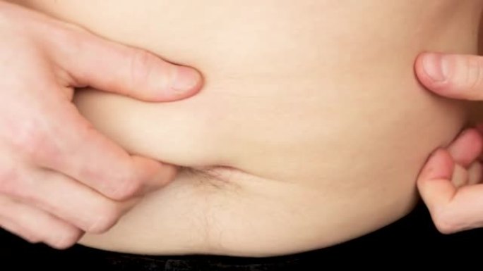 男人肚子胖。脂肪褶皱，皮下脂肪组织。腰围，超重。