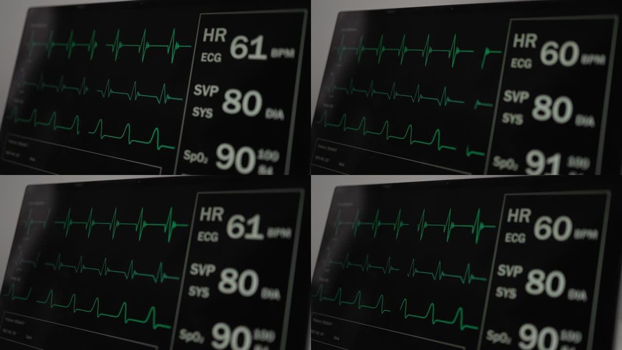 循环: 患者监护仪显示生命体征心电图心电图EKG，血氧饱和度SPO2和呼吸。体检。4k视频录像动画。