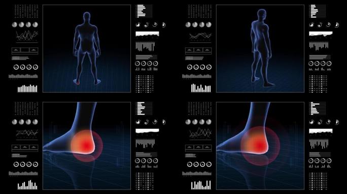 有病理学的人。男孩的3d身体。男性人形。