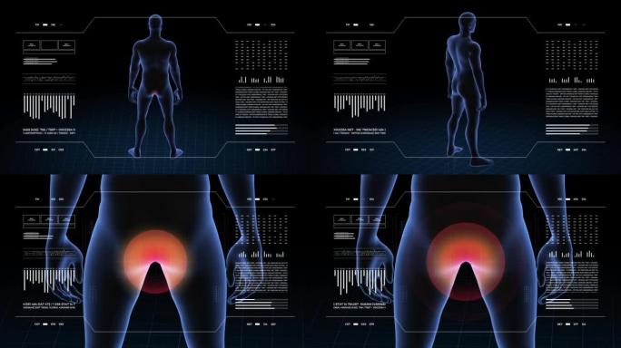 肛门病变的人。男孩的3d身体。男性人体结构的旋转动画和特写。