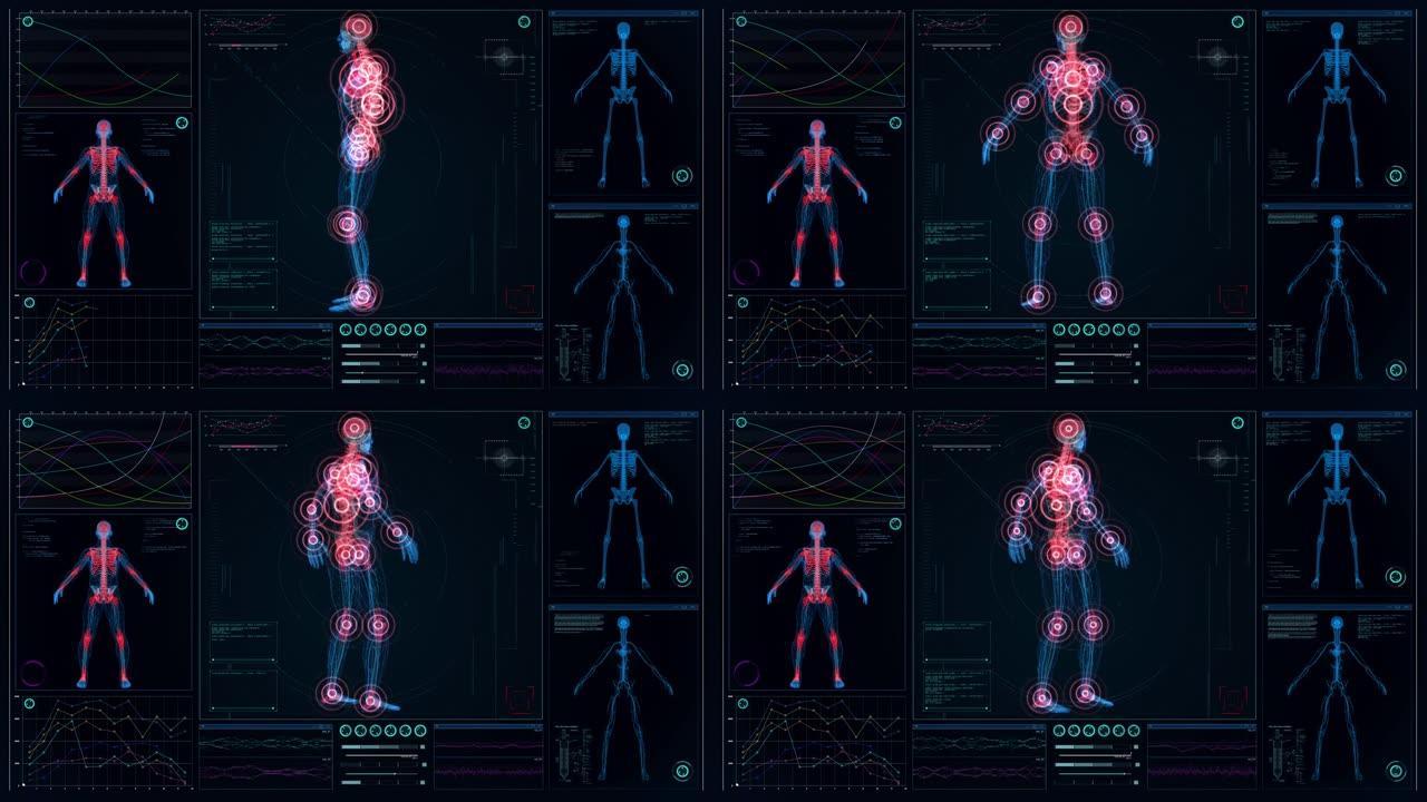 未来实验室。带有动画人体模型的屏幕。扫描虚拟病人是否受伤。