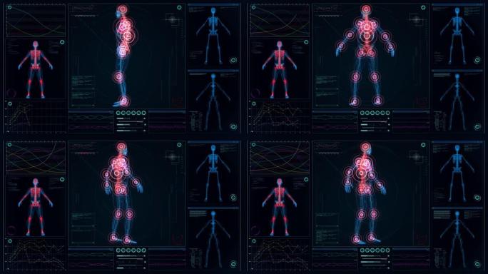 未来实验室。带有动画人体模型的屏幕。扫描虚拟病人是否受伤。