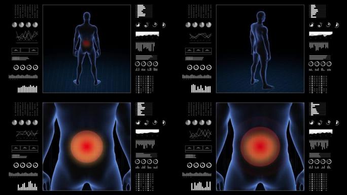 患有腰椎病变的人。男孩的3d身体。男性人体结构的旋转动画和特写。