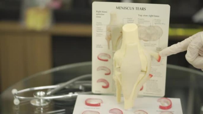 膝关节结构，骨关节炎，特写，医学背景，教程，教学，教育，视频，慢动作的模型。