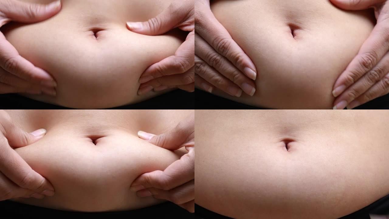 超重妇女腹部肚子上的脂肪太厚