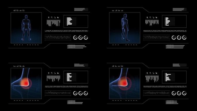 有病理学的人。男孩的3d身体。男性人形。