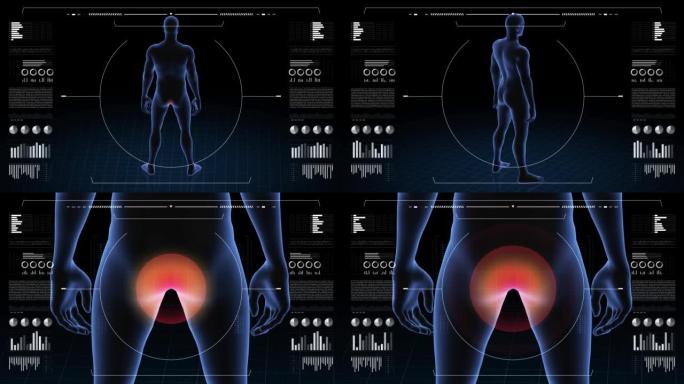 有病理学的人。男孩的3d身体。男性人形。