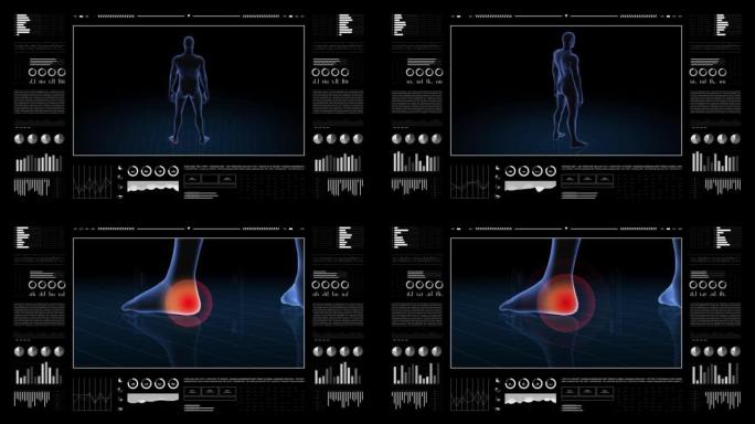 有病理学的人。男孩的3d身体。男性人形。