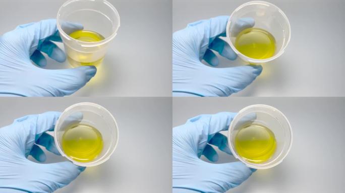 生物材料医用容器中的尿液样本。