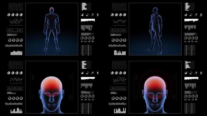 患有头痛病理的人。男孩的3d身体。旋转ani