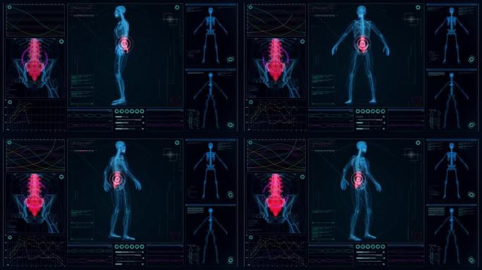 未来实验室。带有动画人体模型的屏幕。扫描虚拟病人是否受伤。带有红点的脊柱