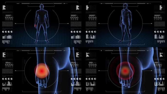 有病理学的人。男孩的3d身体。男性人形。