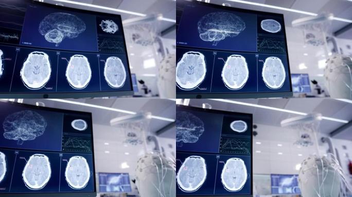 实验室设备、脑电波扫描耳机和计算机。屏幕上的脑电波研究。
