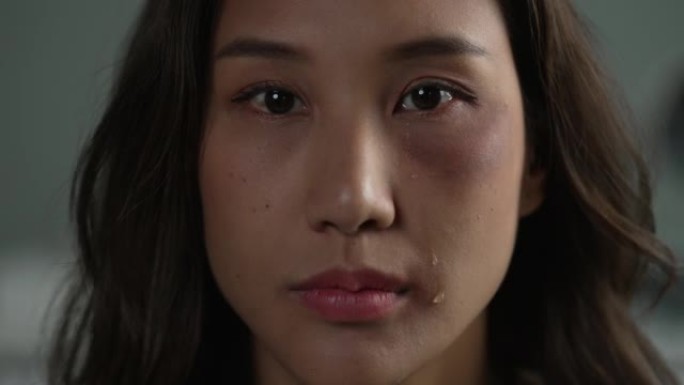 一个脸上有淤青的年轻亚洲女人。家庭暴力中女人被男人暴打。家庭问题，家庭暴力。