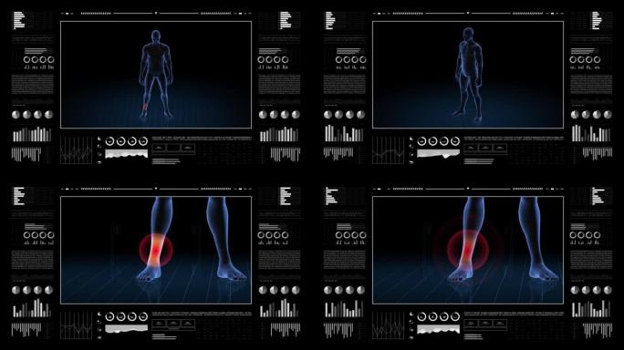 有病理学的人。男孩的3d身体。男性人形。