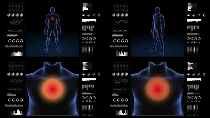 有胸部病理的人。男孩的3d身体。男性人体结构的旋转动画和特写。