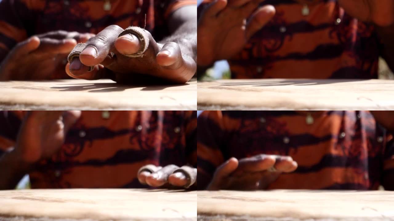 黑人用手指上的石膏演奏djembe的近距离镜头